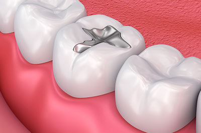 Granger Dentistry | Orthodontics, Dental Lab and Dental Fillings