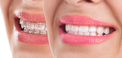 Granger Dentistry | Cosmetic Dentistry, Dental Cleanings and Oral Cancer Screening