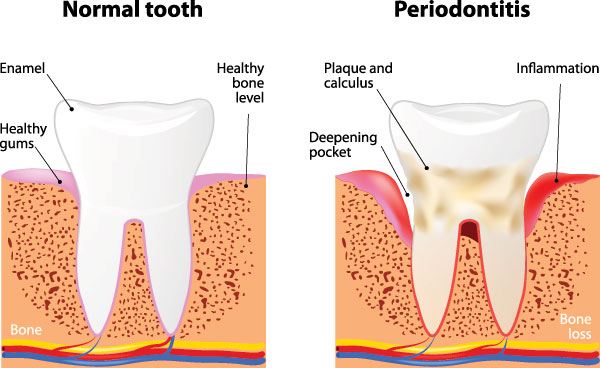 Granger Dentistry | Juvederm reg , Root Canals and Sedation Dentistry