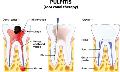 Granger Dentistry | Cosmetic Dentistry, LANAP reg  and Dental Fillings