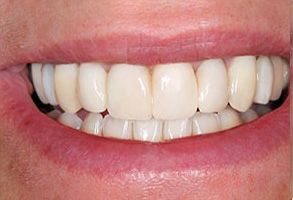 Granger Dentistry | Veneers, Sedation Dentistry and CBCT